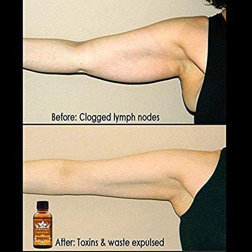3 Pack Lymphatic Drainage Ginger Oil, Ginger Massage Oil to Promote Blood Circulation,Suitable for Body Massage。