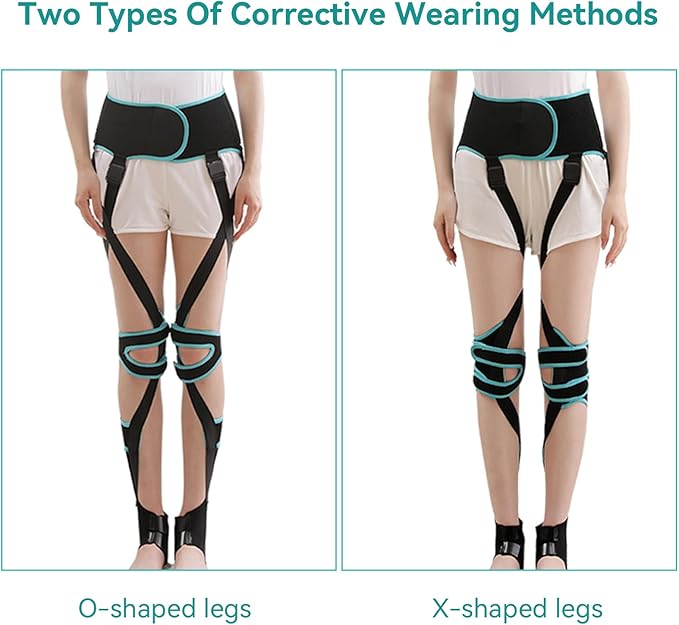 Agatige Leg Corrector Strap, High Elasticity O X Type Leg Correction Bandage Legs Posture Corrector Brace Foot Correction Belt for Adults(L(59.1-66.9in))