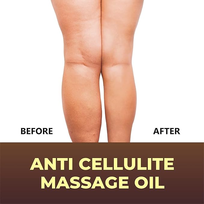 First Botany, Anti-Cellulite Massage Oil Infused with Collagen & Stem Cells - Natural Cellulite & Stretch Mark Treatment for Men & Women - 8 oz (Pack of 2)