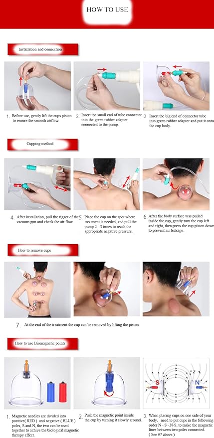 Kangzhu 24-Cup Biomagnetic Chinese Cupping Therapy Set