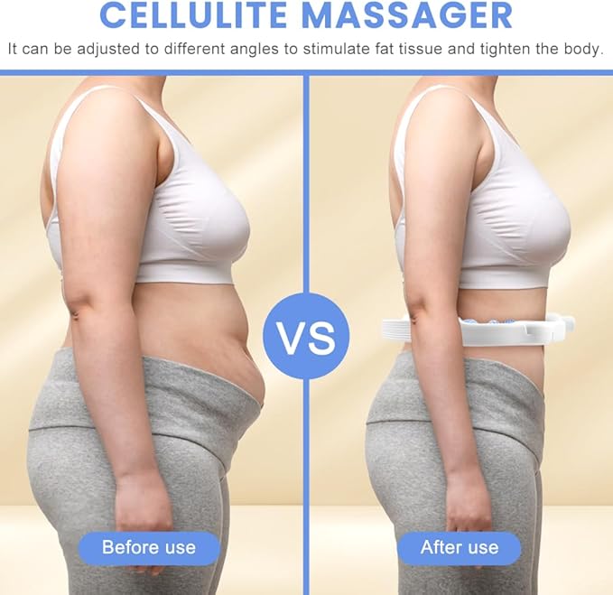 Cellulite Massage Tool, Lymphatic Drainage Cellulite Remover for Legs, Anti-Cellulite Massager with Detachable Roller Handles for Thighs, Legs & Buttocks(Color:Blue)