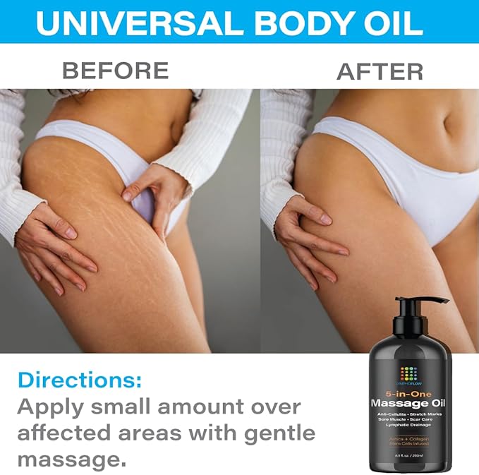 Bruizex Lymphatic Drainage Massage Oil with Arnica, Collagen and Stem Cells, Post Surgery Recovery &, Liposuction, 360 Lipo, BBL, Tummy Tuck, Fibrosis Treatment, 8.5 Oz