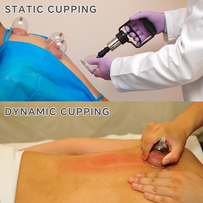 Cupping Kit for Massage Therapy Set with Pump 24 Massage Cups for Cellulite Reduction Muscle Back Pain Relief