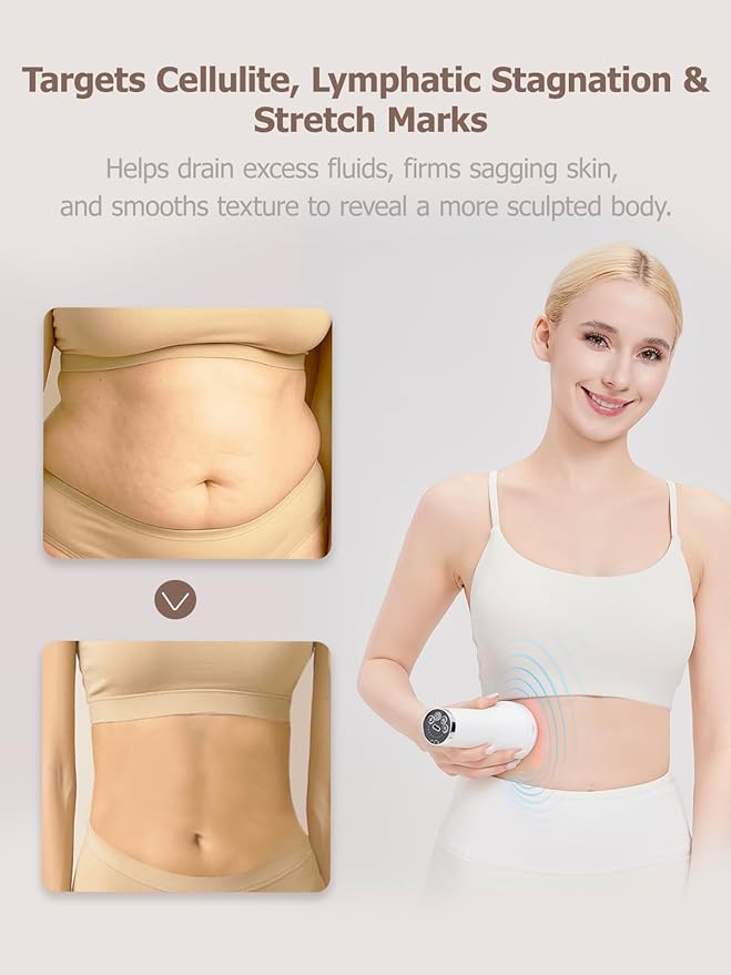 DiDEER Lymphatic Drainage Massager & Anti Cellulite Massage Tool, for Legs, Arms & Belly, Body,Helps Reduce Stretch Marks & Cellulite,with Microcurrent, Light Heat & Vibration (White)