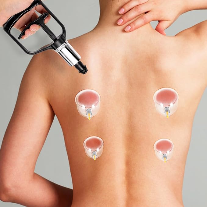Cupping Pump Hand Vacuum Pump Replacement Strong Suction Manual Pressure Cupping Tool for Muscles, Physical Therapy