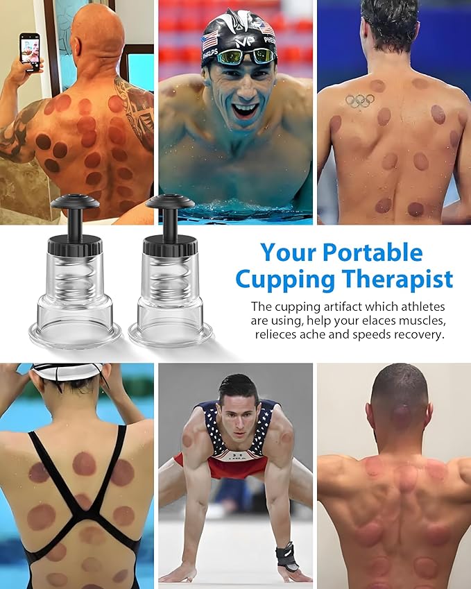 Cupping Kit for Massage Therapy, 2 Sizes Cupping Set, Unique Piston Design, Portable Massager for Studio & Home Use, Muscle Pain Relief, Myofascial Release, Cellulite Reduction (4 Pack)