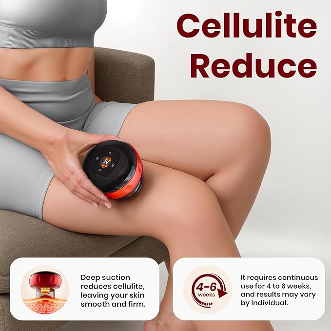 Becommend 5-in-1 Smart Dynamic Cupping Therapy Set with 20-Level Heat & Suction, Cupping Kit for Massage Therapy, Electric Cupping Device with Red Light for Back Pain, Knots, Soreness Relief (Red)