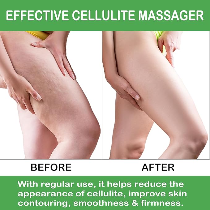 Cellulite Massage Tool Leg Roller. Lymphatic Drainage Massager Muscle Roller with Spiky Balls for Thigh Calf Arm Back Buttock. Fascia Blaster for Circulation Deep Tissue Pain Relief Recovery (Blue)