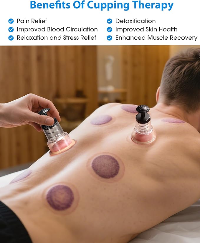 Cupping Kit for Massage Therapy, 2 Sizes Cupping Set, Unique Piston Design, Portable Massager for Studio & Home Use, Muscle Pain Relief, Myofascial Release, Cellulite Reduction (2 Pack)