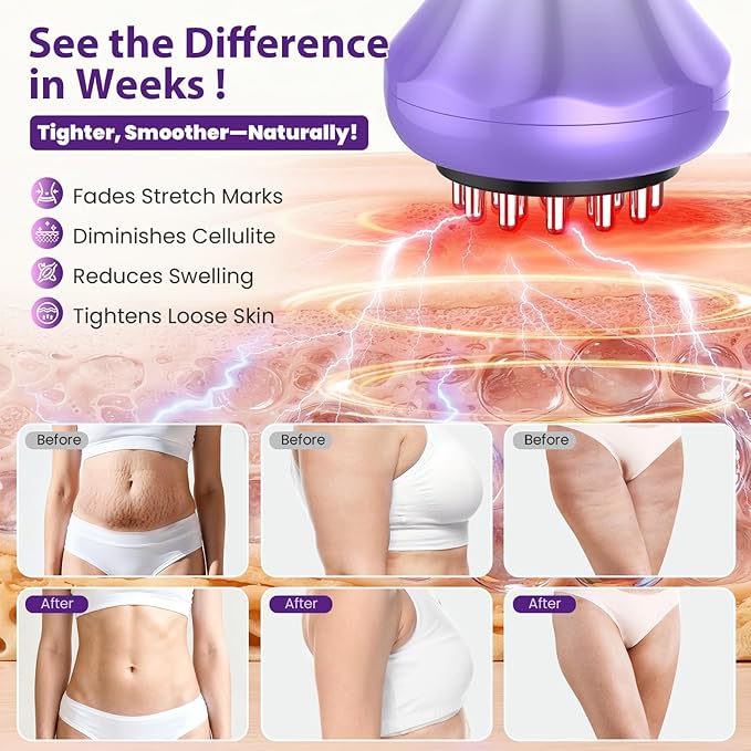 Lymphatic Drainage Massager, Anti Cellulite Massage Tool For Thigh & Belly Stretch Marks & Cellulite Reduction, Handheld Massage tools for Sciatica Nerve, Legs, Arms, Hip, Muscle, Low Back Pain Relief
