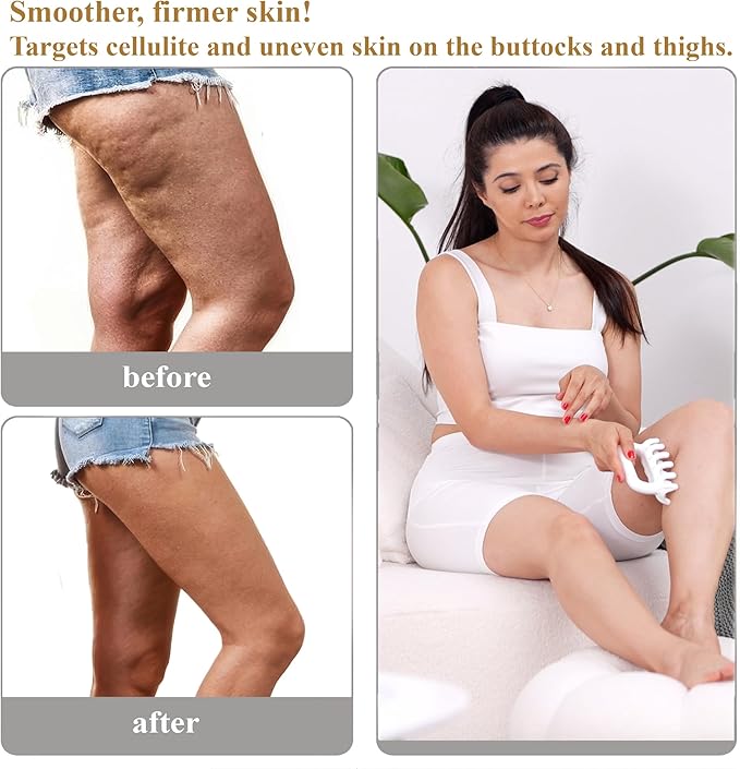Fascia Massage Tool Trigger Point Massage Tools Anti Blaster for Cellulite Massager Tool Reaching Deep Myofascial Tissue Throughout The Body Release Muscle Knot Reduction (Blue)