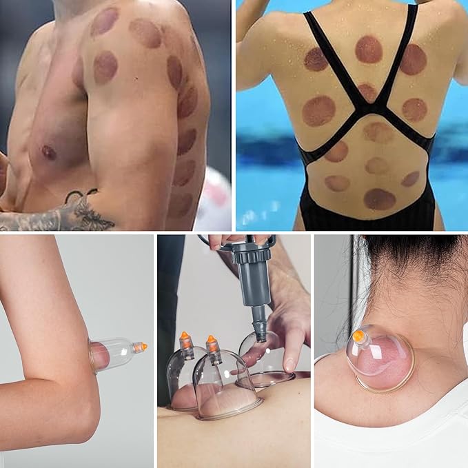 Ditind Cupping Therapy Set, 18 Pcs Cupping Set, Professional Cupping Kit for Massage Therapy, Portable Upgrade Cupping with Case, Pump Suction Cups for Cellulite Muscle Pain Relief Physical Therapy.