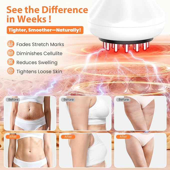 Body Sculpting Machine, Lymphatic Drainage Massager & Anti Cellulite Massage Tool, Helps Reduce Stretch Marks & Cellulite, Targeted Relief for Sciatica, Nerve, Hip, Joint & Muscle and Lower Back Pain