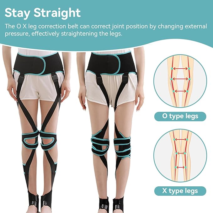 Leg Corrector Strap, High Elasticity O X Type Leg Correction Bandage Legs Posture Corrector Brace Foot Correction Belt for Adults(M(51.2-59.1in))