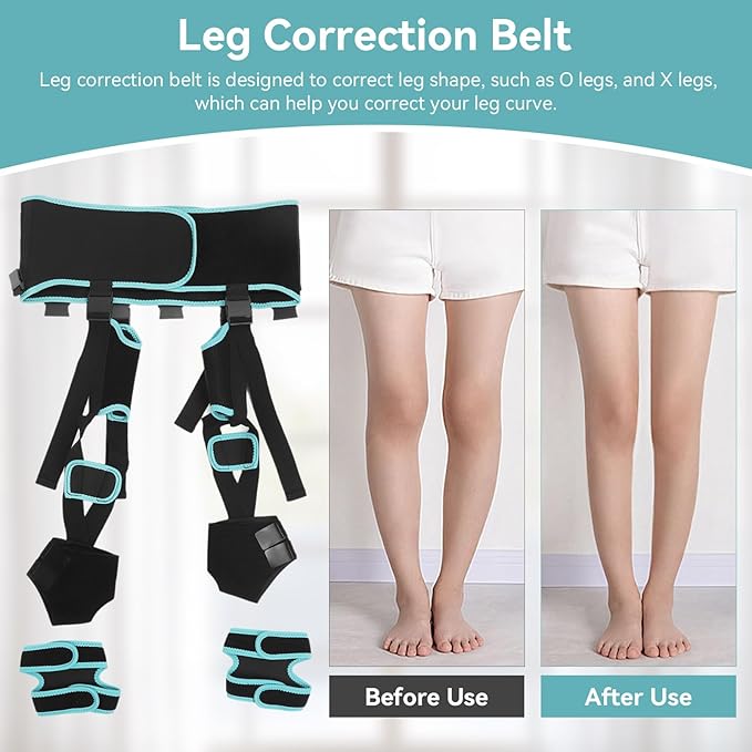 Leg Corrector Strap, High Elasticity O X Type Leg Correction Bandage Legs Posture Corrector Brace Foot Correction Belt for Adults(M(51.2-59.1in))