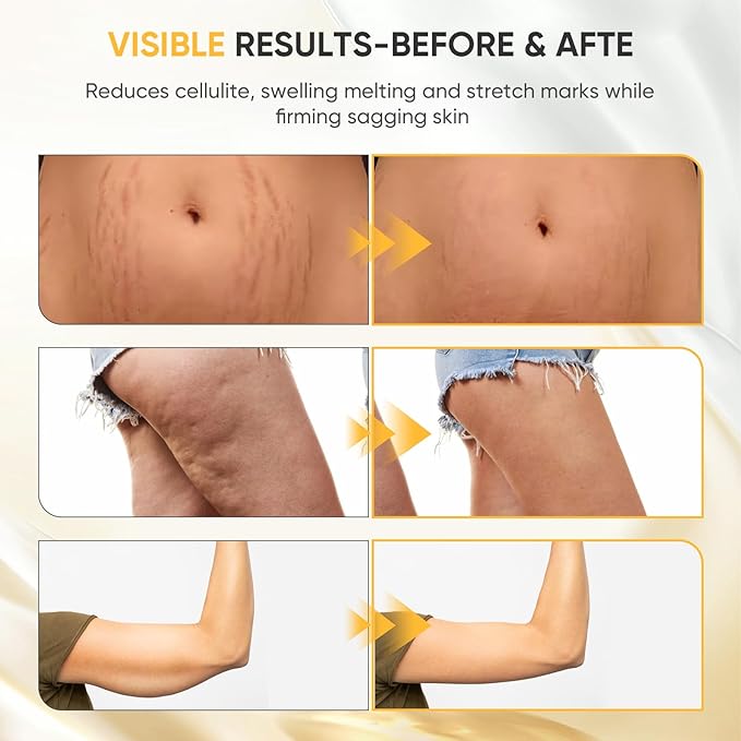 Lymphatic Drainage Massager - Anti Cellulite Massage Tool & Body Sculpting Machine with 30-Level Microcurrent, Light Heat & Vibration for Legs Arms & Belly Body Helps Reduce Stretch Marks & Cellulite