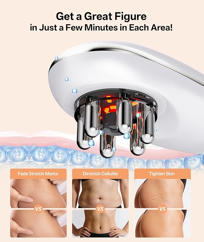 Body Sculpting Machine with Red Light Therapy for Face & Body, Cupping Therapy, Electric Cellulite Massage Tool with 2 Cups, Gift for Women, White