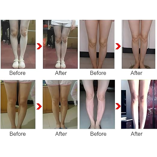 Leg Correction Belt - Adjustable Posture Corrector Belt - O/X Air Pressure Corrector Bandage, Bow Leg corrector, Easy to Correct for Children and Adults