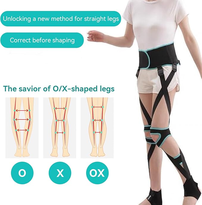 Agatige Leg Corrector Strap, High Elasticity O X Type Leg Correction Bandage Legs Posture Corrector Brace Foot Correction Belt for Adults(L(59.1-66.9in))