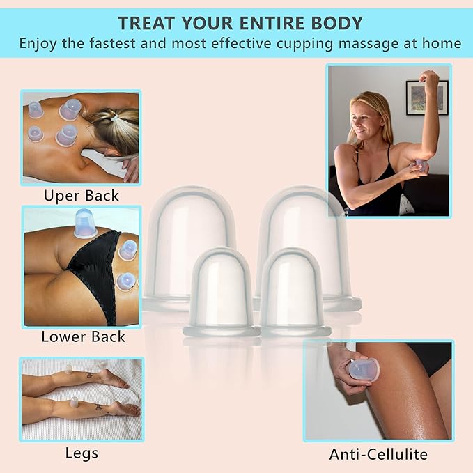 Silicone Cupping Therapy Set – 4 Massage Cups (2 XL, 2 L) – Pain Relief, Muscle Recovery & Cellulite Reduction – Professional Cupping Kit for Home, Gym & Athletes