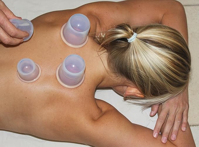 Silicone Cupping Therapy Set – 4 Massage Cups (2 XL, 2 L) – Pain Relief, Muscle Recovery & Cellulite Reduction – Professional Cupping Kit for Home, Gym & Athletes