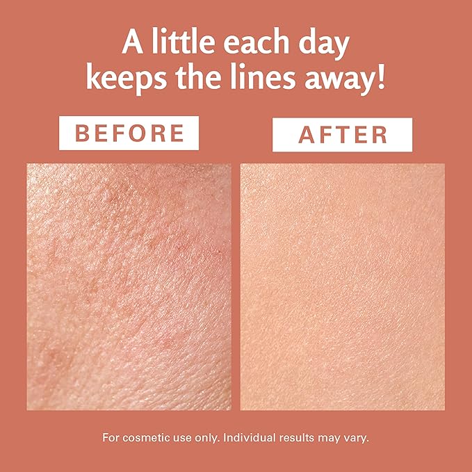 Frankincense Essential Massage Oil for Scars, Stretch Marks & Fine Lines, Firming, Hydrating, Smoothing & Calming Formula with Collagen, Stem Cells, Lavender & Grapefruit, 8 fl oz, by M3